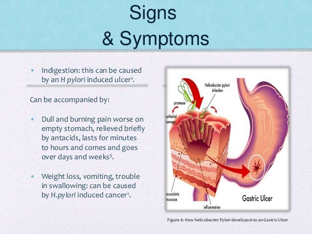 helicobacter pylori symtom